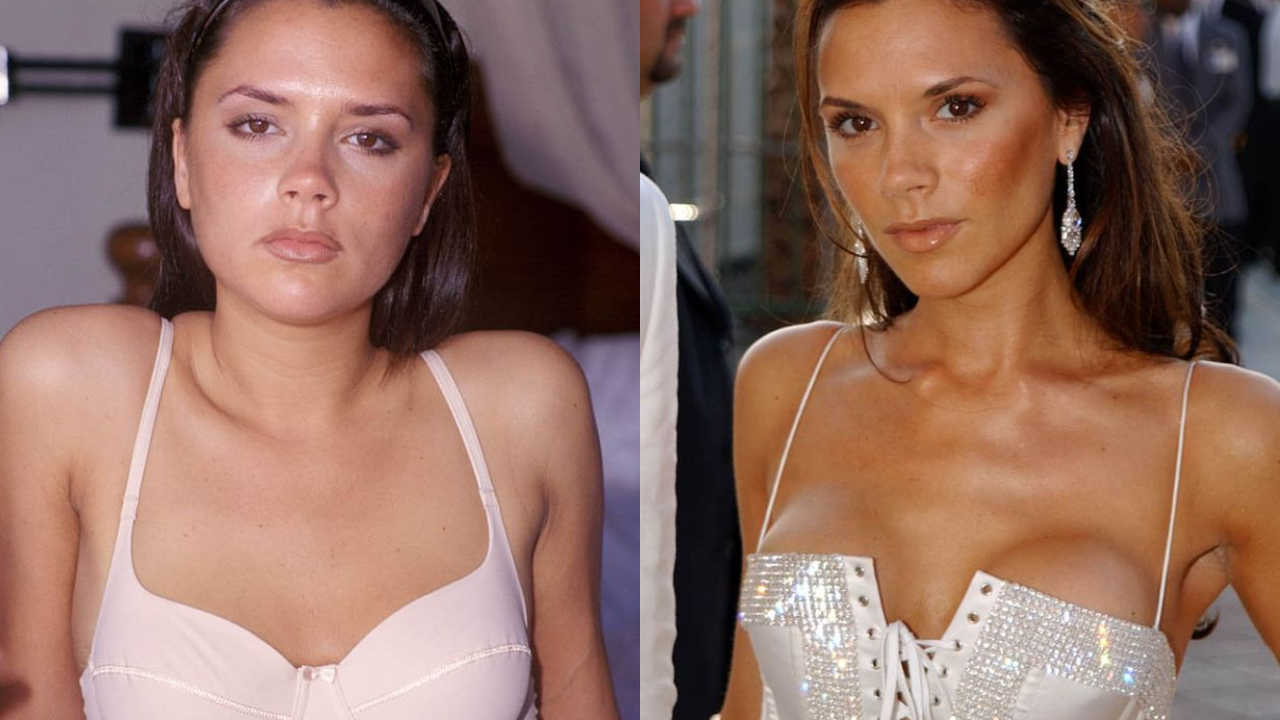 Victoria Beckham before and after breast implant.