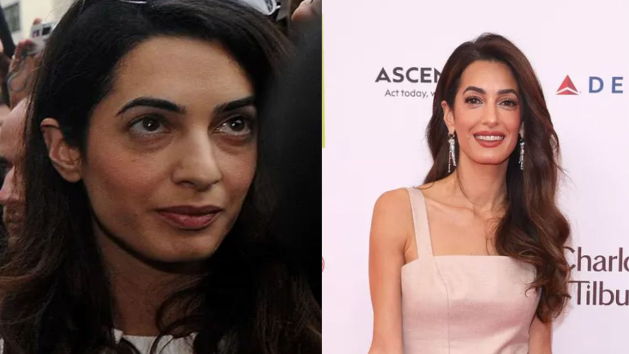 Amal Clooney’s Plastic Surgery: All About Her Beauty Secret. weightandskin.com