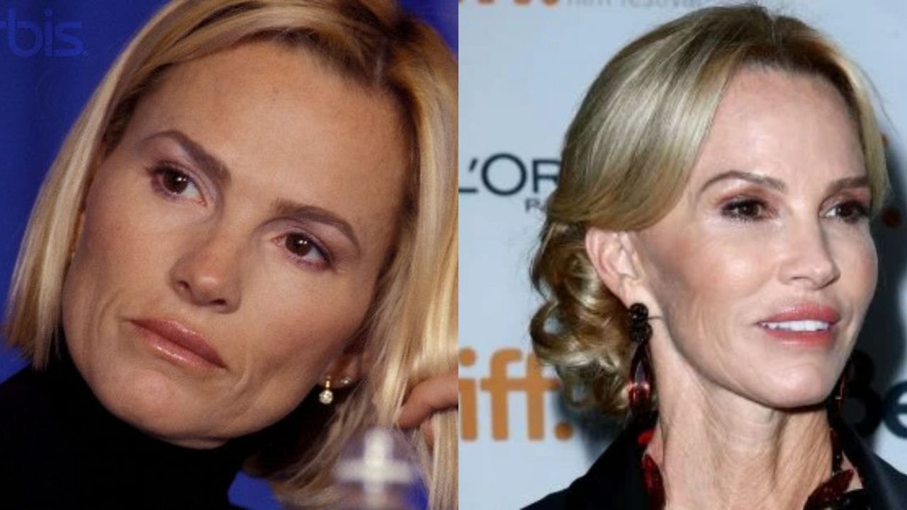 Janet Gretzky before and after plastic surgery.