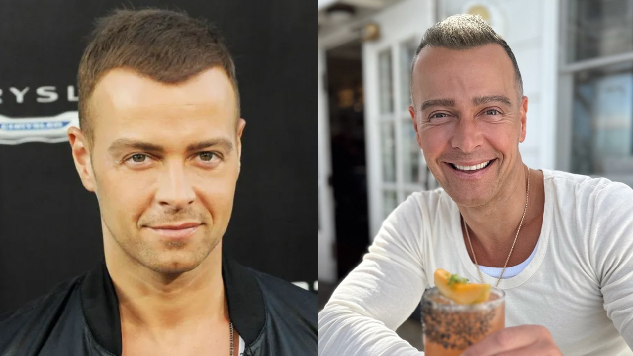 Joey Lawrence’s Plastic Surgery: Here’s What He Said About It