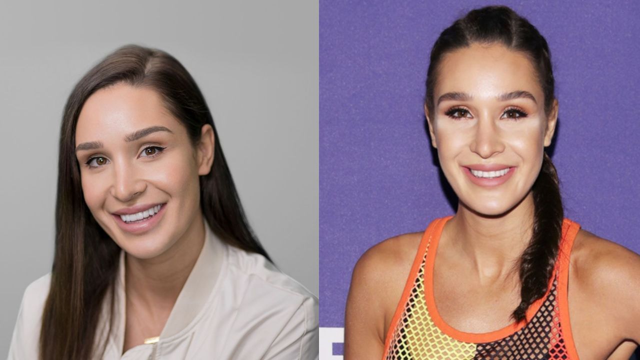 Kayla Itsines before and after plastic surgery.