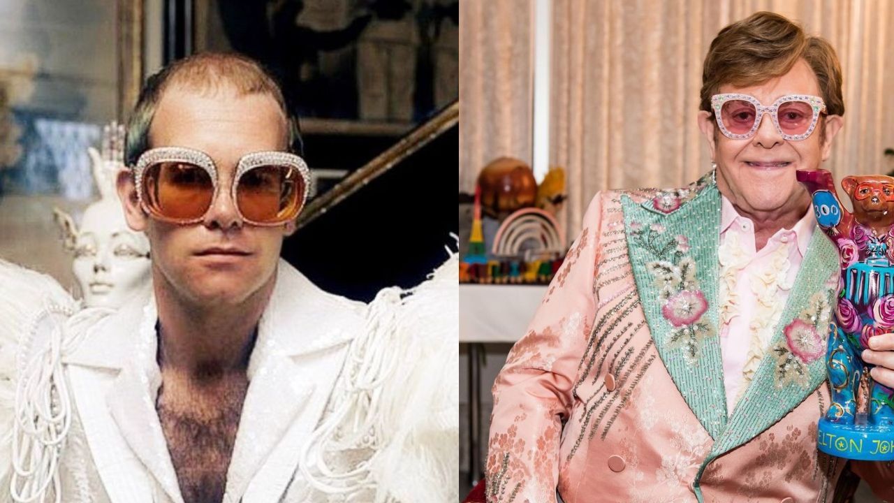 Elton John hasn't confirmed receiving any plastic surgery. weightandskin.com
