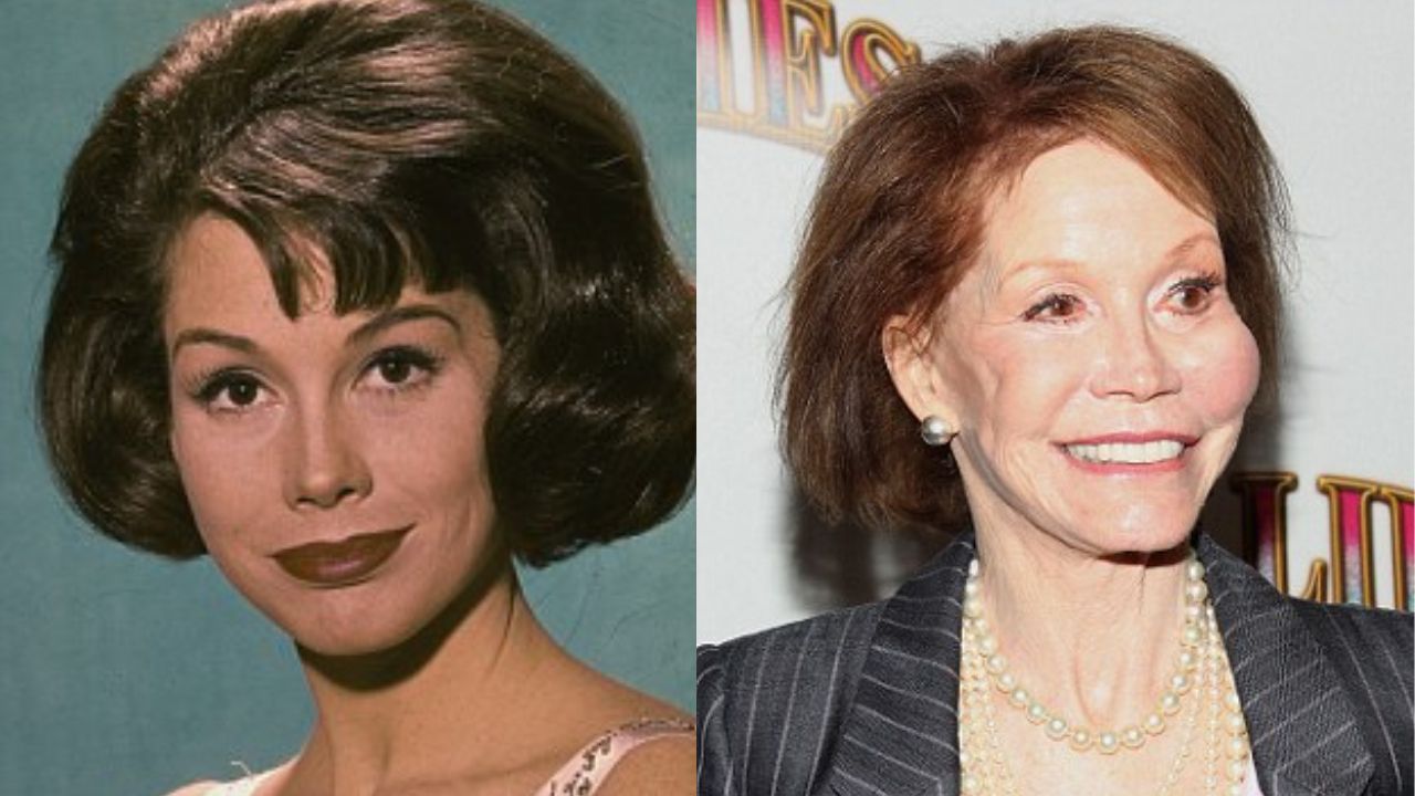 Mary Tyler Moore’s Plastic Surgery: All the Cosmetic Treatments Discussed! weightandskin.com
