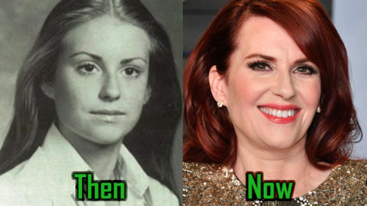 Megan Mullally before and after plastic surgery. weightandskin.com