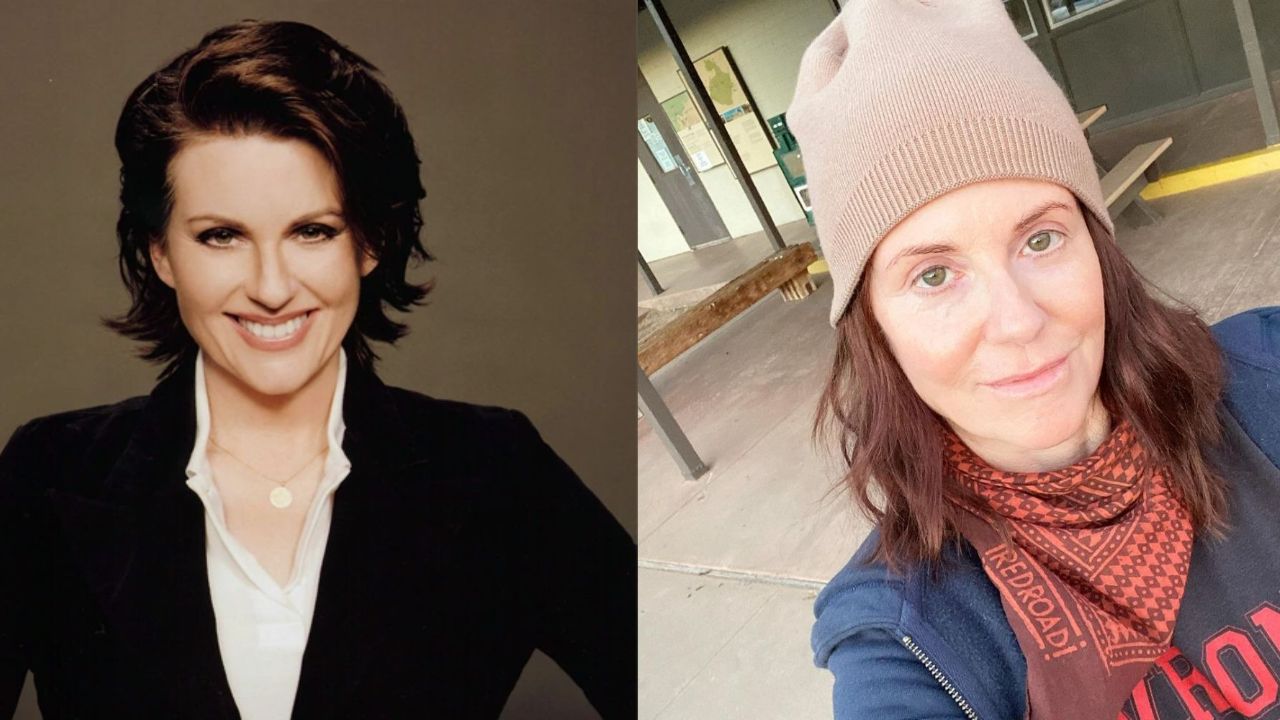 Megan Mullally’s Plastic Surgery: Learn What the Truth Is! weightandskin.com