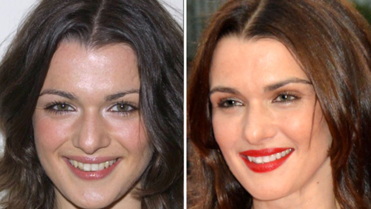 Rachel Weisz before and after plastic surgery. weightandskin.com