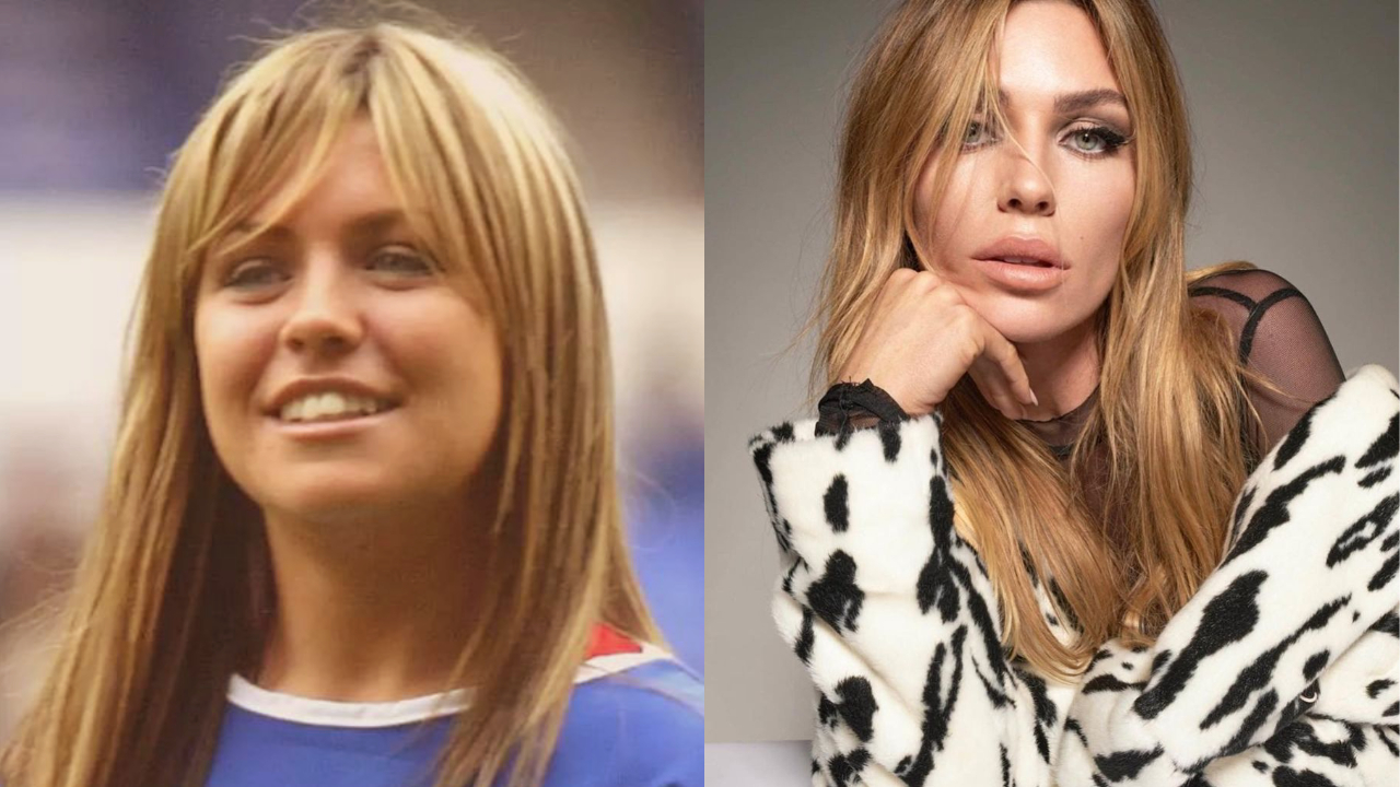 Abbey Clancy Plastic Surgery: Are the Rumors About Nose Job, Lip Fillers, Botox Injections, and Jaw Surgery True? weightandskin.com