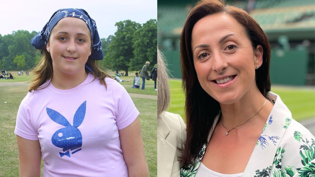Natalie Cassidy Plastic Surgery: Did She Gets Botox Injection and Facelift? weightandskin.com