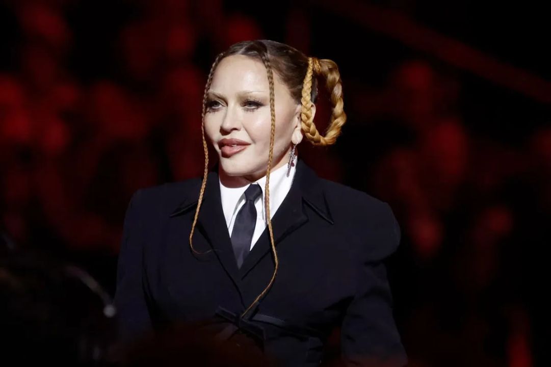 Madonna is said to have had multiple plastic surgery procedures. weightandskin.com