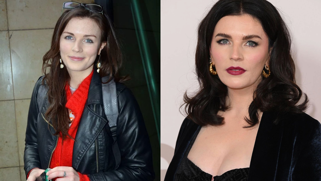 Aisling Bea’s Accused of Plastic Surgery; Botox, Fillers & More! weightandskin.com