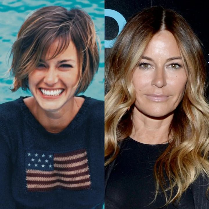 Kelly Bensimon before and after rhinoplasty. weightandskin.com