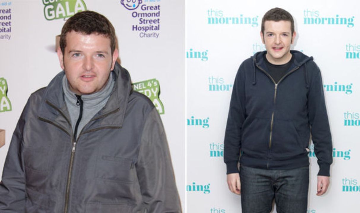 Kevin Bridges before and after weight loss. weightandskin.com