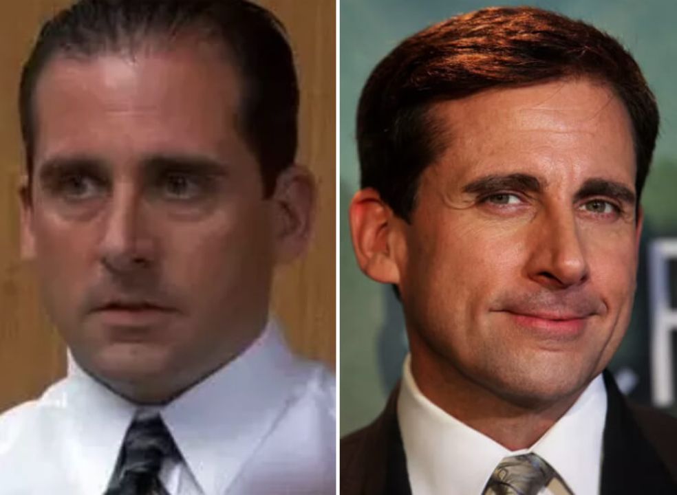 Steve Carell before and after hair transplant. weightandskin.com