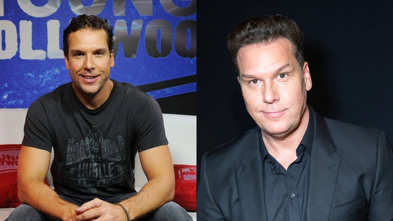 Dane Cook Plastic Surgery: Examining the Signs & Expert Opinions weightandskin.com