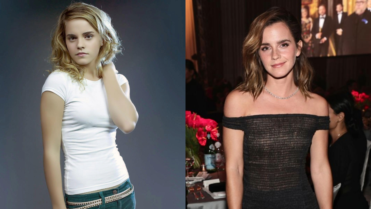 Emma Watson Breast Implant Rumors Debunked; Fact vs. Fiction weightandskin.com
