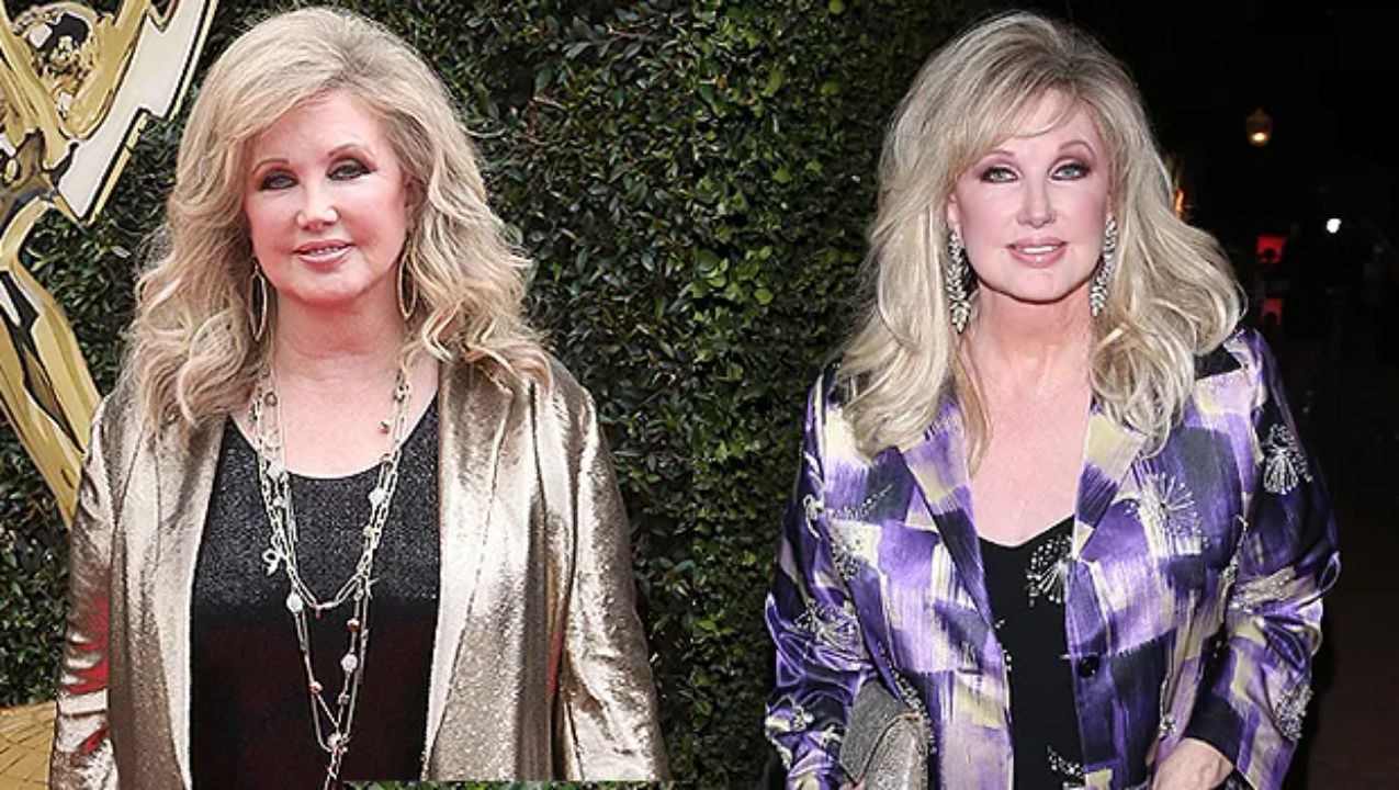 Morgan Fairchild before and after weight loss. weightandskin.com