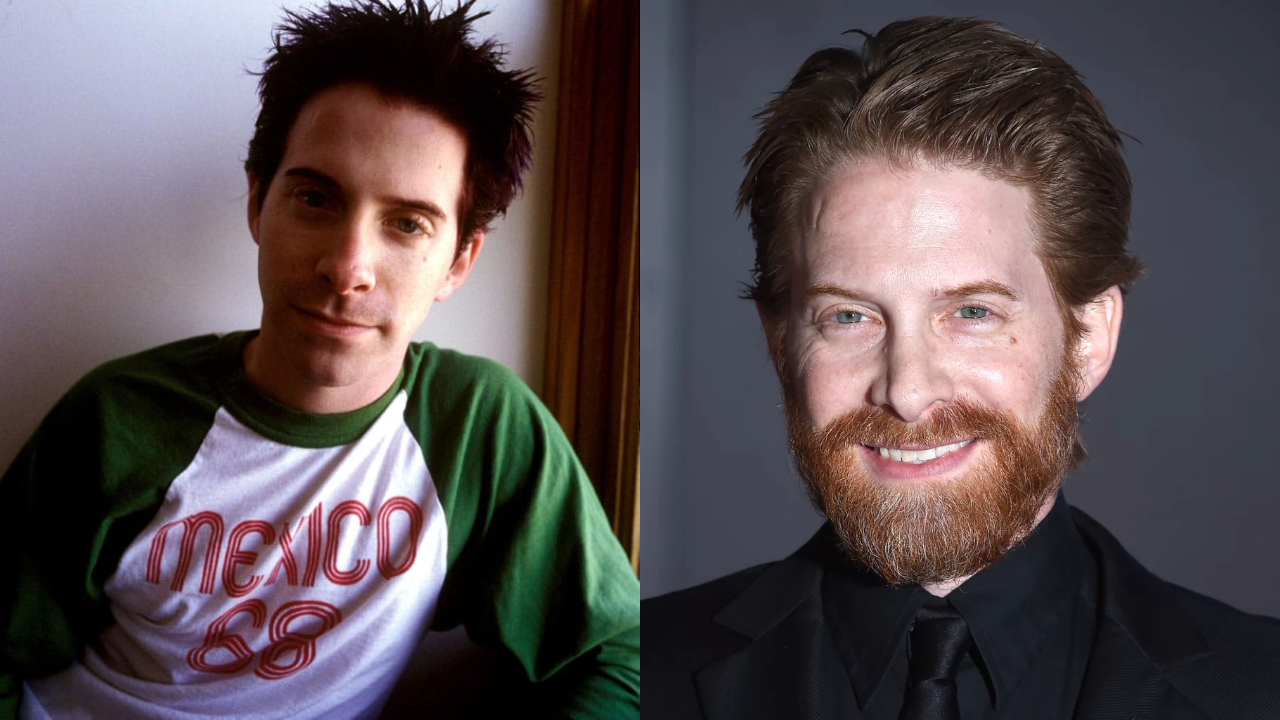 Seth Green Accused of Getting Plastic Surgery to Escape Aging weightandskin.com