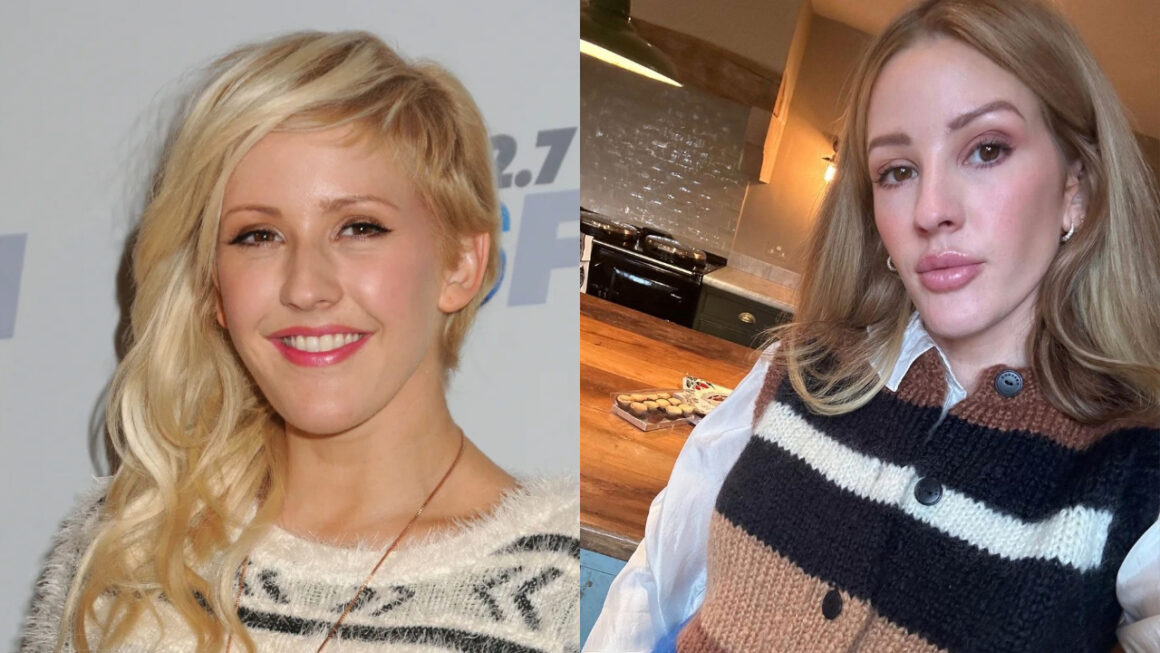 Ellie Goulding Plastic Surgery: Before & After Photos Clues! weightandskin.com