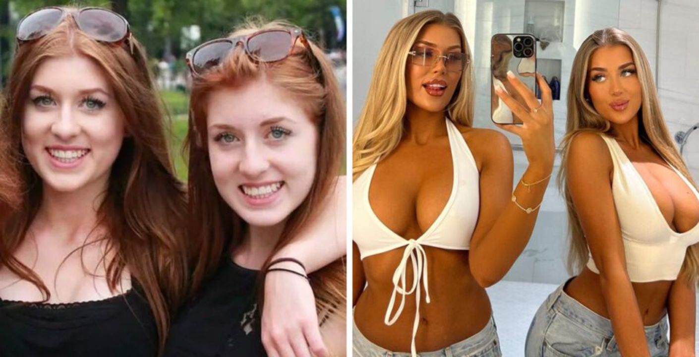 Jess and Eve before and after plastic surgery. weightandskin.com