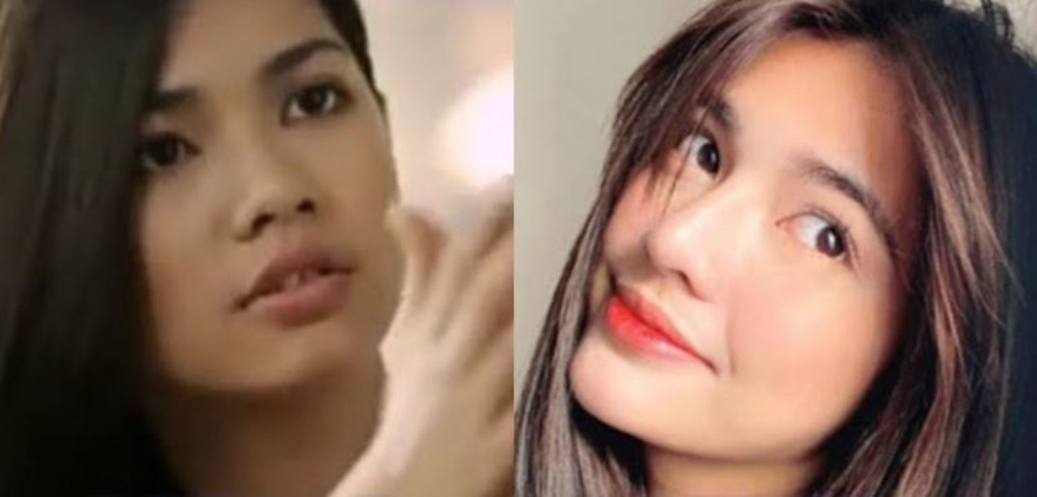 Jane de Leon before and after cosmetic enhancement. weightandskin.com