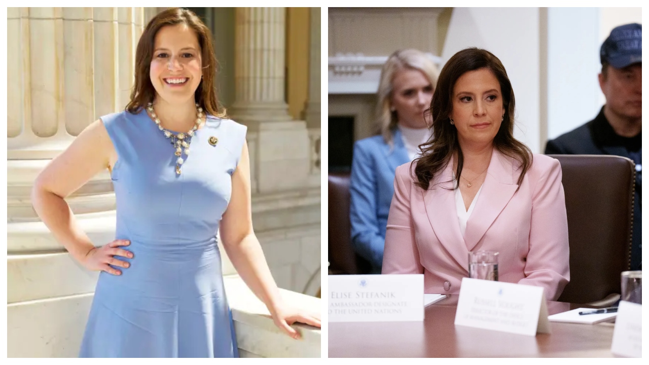  Elise Stefanik Plastic Surgery before after
